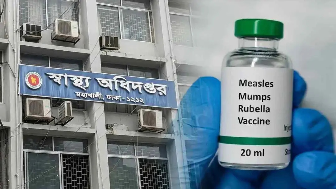 হাম ও উপসর্গে মৃত্যু ১১০০ ছাড়িয়েছে